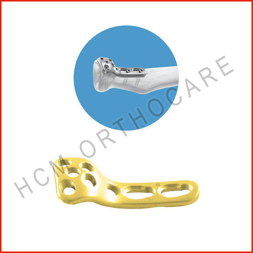 2.7mm-redial-head-rim-locking-plate