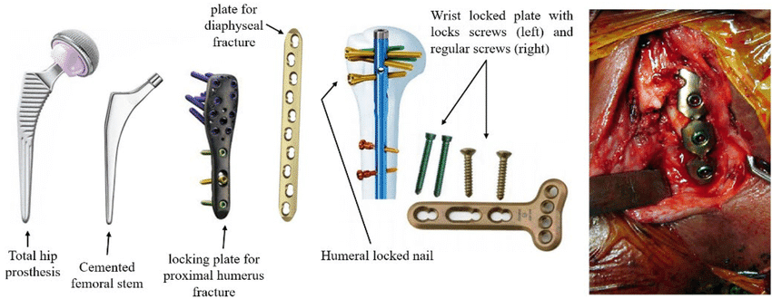 orthopedic-implants-instrument - HCM Ortho orthopedic-implants-instrument