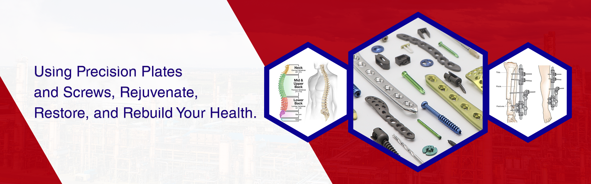 banner - Using Precision Plates and Screws, Rejuvenate, Restore, and Rebuild Your Health